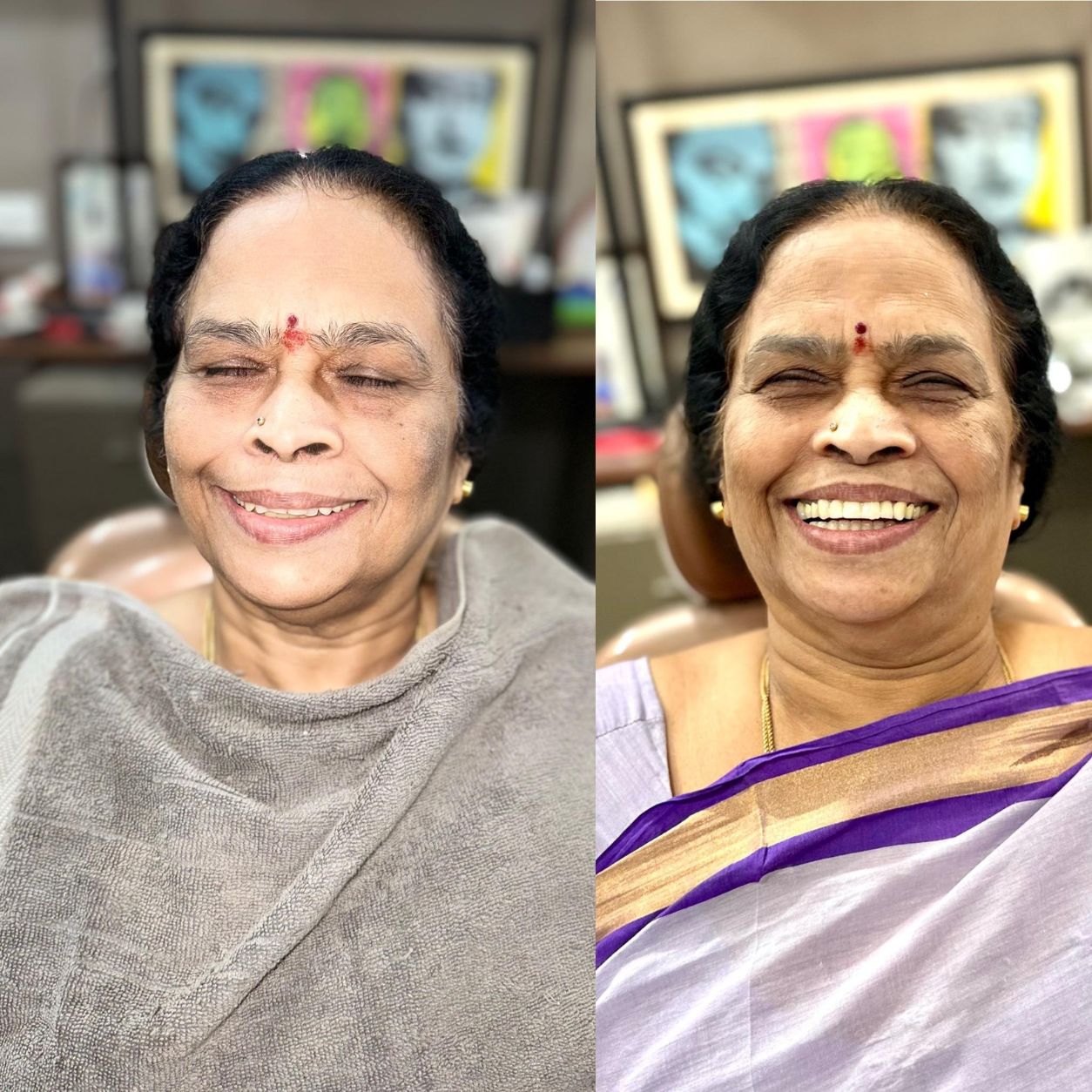 Full Smile Makeover & Restoration
