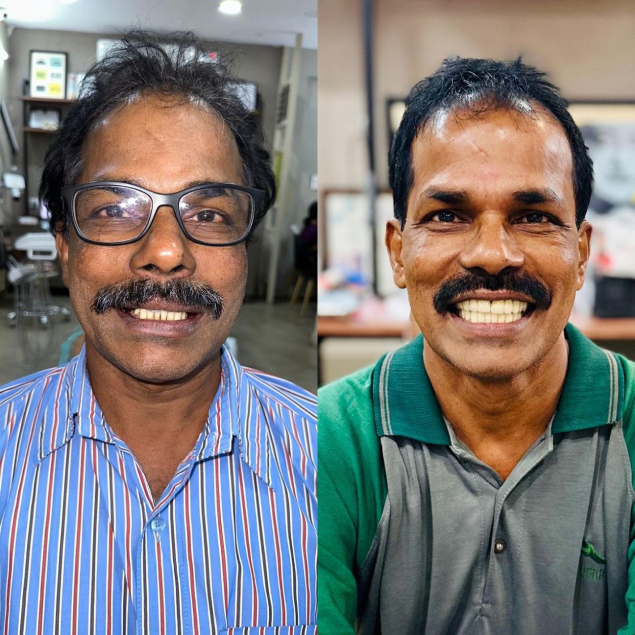 Full Smile Makeover & Restoration
