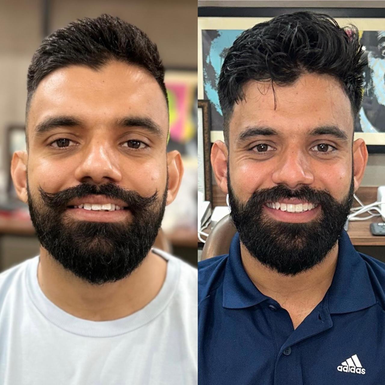 post Braces treatment